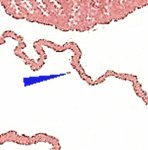 TD B ZP 74 b 