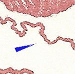 TD B ZP 86 c 