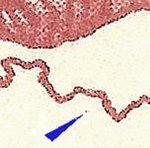 TD B ZP 99 c 